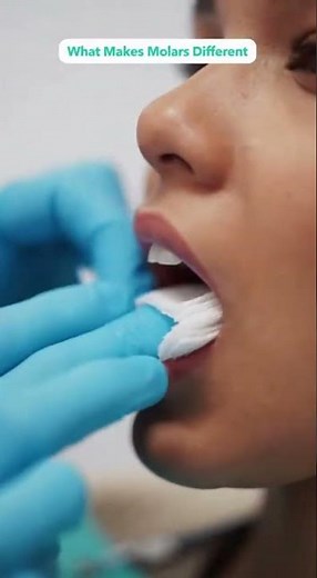 🦷 Need a Back Molar Pulled? Here’s What to Expect