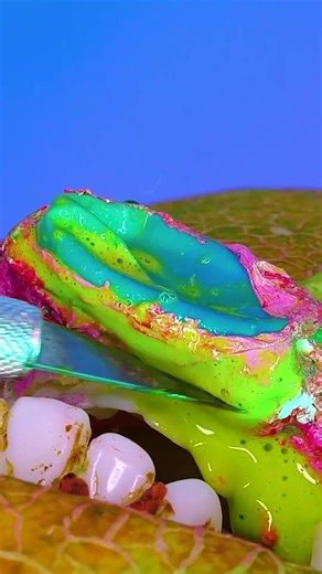 This Teeth Transformation Is SHOCKING! 🤢 #Shorts