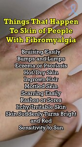Things that happen to the Skin of people with Fibromyalgia #fibromyalgia #chronicpain #chronicillness #health #pain #fatigue #skincare | Fibrowarrior