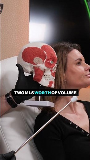 Masseter Botox can make jowls worse… here’s why