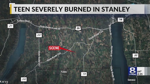 15-year-old in critical condition after gasoline explosion in Ontario County