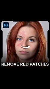 ✅ Transform Your Skin – How to Remove Red Patches from Skin with Photoshop | Graphic Station