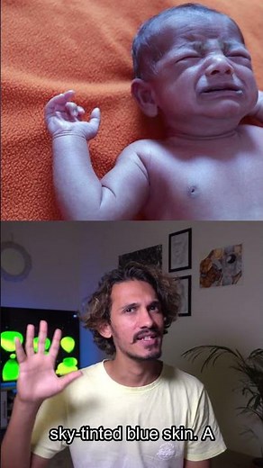 The Blue People of Kentucky: A Genetic Mystery