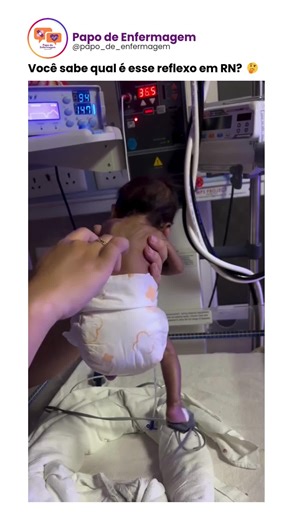Papo de Enfermagem on Instagram: "O reflexo de Galant é um dos reflexos primitivos avaliados nos recém-nascidos e faz parte da observação clínica do desenvolvimento neurológico. Ele ajuda a identificar a integridade da medula espinhal e do sistema nervoso central nos primeiros meses de vida. 🔍 Como funciona: Ao estimular suavemente a região lombar do bebê (traçando o dedo ao longo da coluna), ele tende a inclinar o quadril para o lado do estímulo. 📌 Importância clínica: • Presente desde o nasc