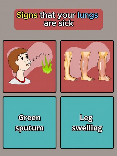 Understanding Lung Health: Causes and Symptoms