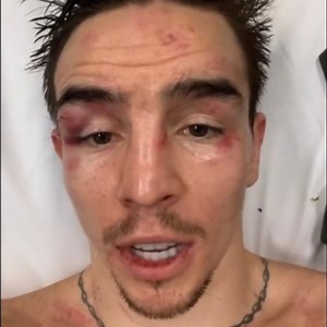 19K views · 548 reactions | ☘️ Michael Conlan gives an update from hospital following his epic battle with Leigh Wood last night.  Michael Conlan  Betfred Fight Odds: https://bfd.me/3fARHIa #Boxing #WoodConlan | Boxing Social | Facebook