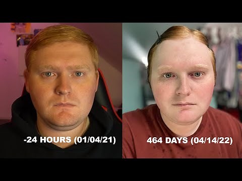 How I started Hormone Replacement Therapy: Male to Female HRT Gender Transition
