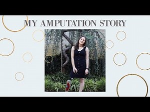 My Amputation Story | 1 in a Million Condition
