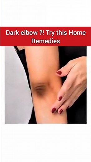 🔥Salon-Like Clean Elbows at Home! | Easy DIY Remedy for dark elbow |