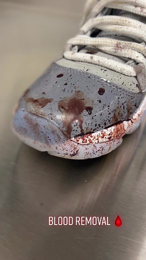How to Clean Blood Stains from Sneakers: A Comprehensive Guide