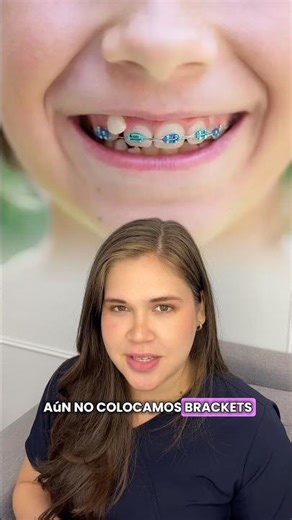 ¿Brackets en niños? #ortopedia #dentista #shortvideo #bracket #viral #greenscreen #limaperu #like
