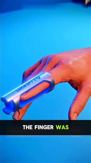 How Doctors Fix A Broken Finger 🦴