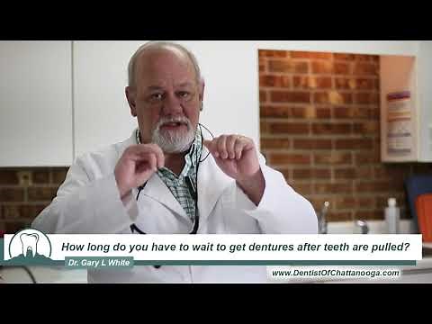 How long do you have to wait to get dentures after teeth are pulled?