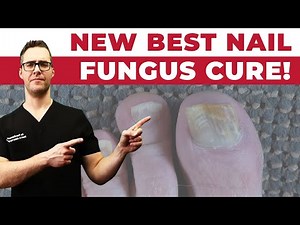 #1 NEW Best Toenail Fungus Treatments [Medications vs Creams vs Laser]