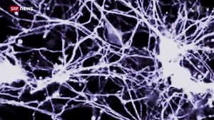 Dokumentarfilm «The Brain»