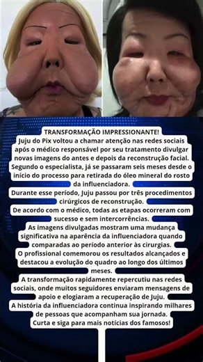 MÉDICO MOSTRA ANTES E DEPOIS DE JUJU DO PIX APÓS RECONSTRUÇÃO FACIAL!
