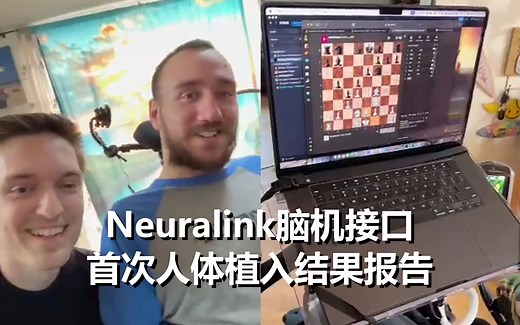 【中文】Neuralink脑机接口首位植入者谈感受