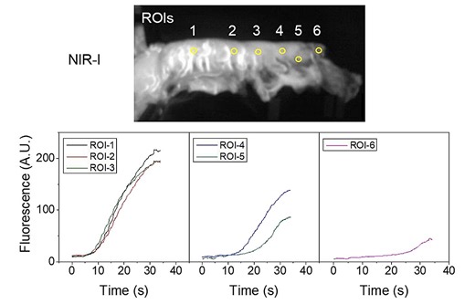 For the first time, next-gen infrared fluorescence imaging helps surgeons see blood perfusion during esophageal surgery