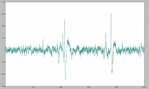 【Python】EEG（脳波）をカオス時系列解析、takensの埋め込み定理「3章」 - FUNC-RETURN
