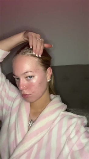 in love with my skin atm #clearskin #accutane