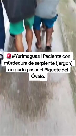 Emergencia en Yurimaguas: Paciente con mordedura de serpiente