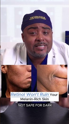 Retinol Won't Ruin Your Melanin Rich Skin
