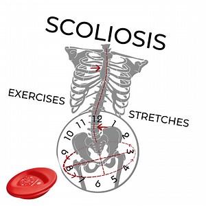 HOME EXERCISE FOR SCOLIOSIS CORRECTION — Pelvic Clock® Exercise Device
