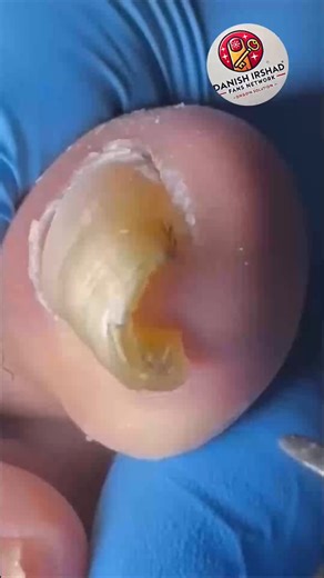 62K views · 319 reactions | 1036. At-home sleep-breathing options: clinician-guided overview (info only) #SleepWellness #HomeWellness #HealthyLiving | Danish irshad fans | Facebook