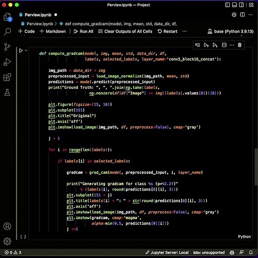 Diagnosis X-Ray Images With Deep Learning