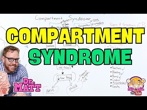 Compartment Syndrome