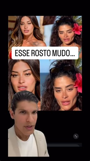 Diego Corrêa | Dermatologista | RQE 3155 on Instagram: "ESSE ROSTO MUDOU? E pode acontecer contigo também, sabia? Assista até o final Deixo os comentários com vcs . Dr. Diego Corrêa CREMESP 235589/ CREMESE 3406 Médico dermatologista RQE 144597/ 3155 Aviso Importante: O conteúdo apresentado neste vídeo tem caráter exclusivamente informativo e educativo. E não subsistiu a consulta médica. O objetivo é esclarecer pontos técnicos sobre os procedimentos faciais , contribuindo para a compreensão do p