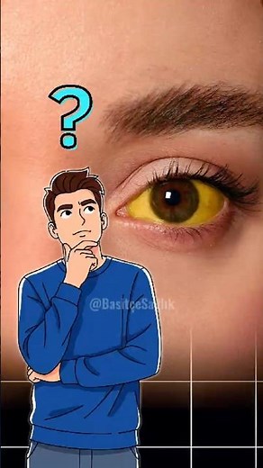 What is jaundice and why does it occur?