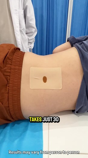 Effective Gout Relief with Our Gout Patch