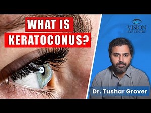 What is Keratoconus? | Keratoconus Treatment | Keratoconus Eye Disease Explained!