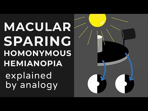 Macular Sparing & Splitting Homonymous Hemianopia | Animation | Explained Conceptually