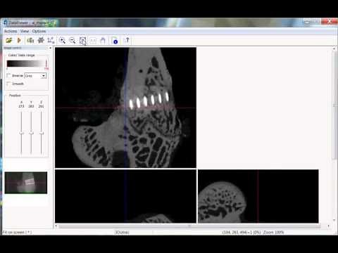 Bruker microCT training video: Introduction to dataviewer