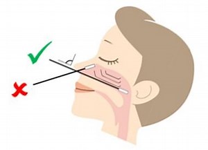 HINT: How to promote comfort and safely perform a nasopharyngeal (NP) swab on children and youth — Connected Care @ SickKids