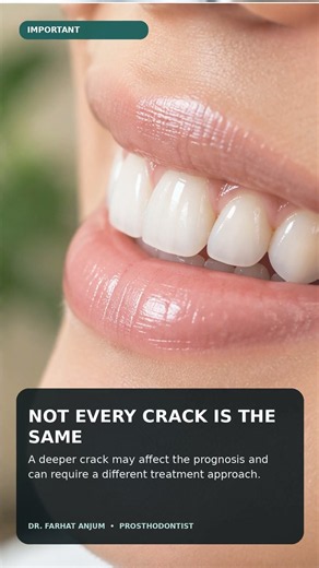 Cracked Tooth? Can It Always Be Saved? 🦷 | Dr. Farhat Anjum