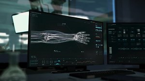 Medical computer system starts high tech analysis of arteries. Medical computer system is analyzing the particles of blood. Medical computer system identifies the Second Blood Type after analysis