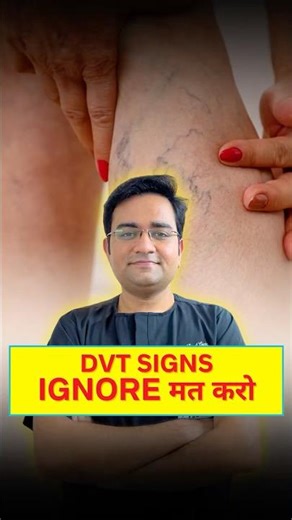 DVT Symptoms Explained | Why is it dangerous to ignore leg swelling?