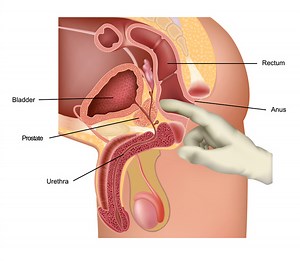 How Can You Stimulate Prostate?
