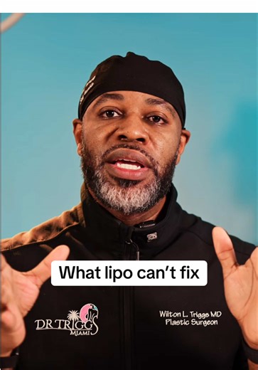 Liposuction can enhance curves, define the abdomen, accentuate muscles, and bring in the waistline. But it cannot fix loose skin. And it definitely cannot replace a healthy lifestyle. If you treat lipo like a free pass to eat anything, the deeper fat around your organs can enlarge. That fat cannot be removed with liposuction. Lipo reshapes what’s under the skin. It doesn’t override biology. 💬 Did you know visceral fat can’t be treated with lipo? #liposuction #realexpectations #bodycontouring #p