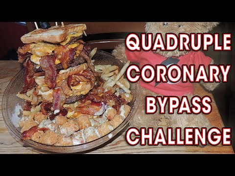 The Vortex's QUADRUPLE CORONARY BYPASS Burger Challenge!!