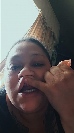 Denture Reveal: A Look Underneath My New Dentures!#dentures #oralhealth #dentalcare