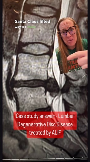 62K views · 877 reactions | Case study - Chronic Lower Back pain...
