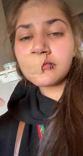 Face hole 🙃 *FAKE BLOOD FAKE INJURY* 😂👌🏽