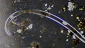 Nematode worm - Microscopic view