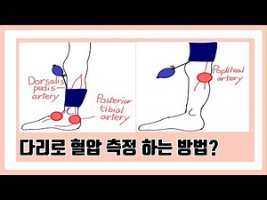 다리로 혈압 재는 방법? 하지혈압측정법 #간호 #간호학과 #간호학생 #간호대생 #간호조무사 #간호사취업 #신규간호사 #혈압측정 #혈압 #하지혈압