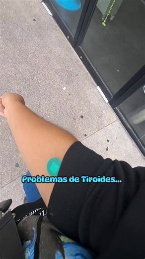 #hipotiroidismo #hashimoto #tiroidesproblemas #tiroides #paratii | hipertiroidismo en mujer