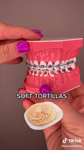 Best Foods to Eat After Getting Braces Part 2